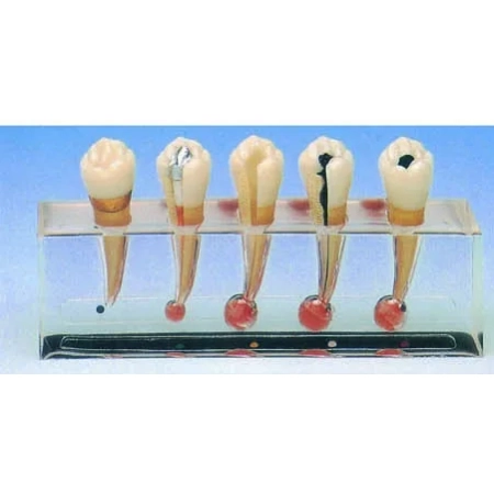 Model chorób endodontycznych HUG/B10015/2